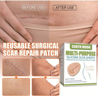 South Moon Silicone Scars Sheets-Suitable for all kinds of scars