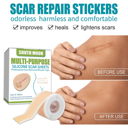 South Moon Silicone Scars Sheets-Suitable for all kinds of scars