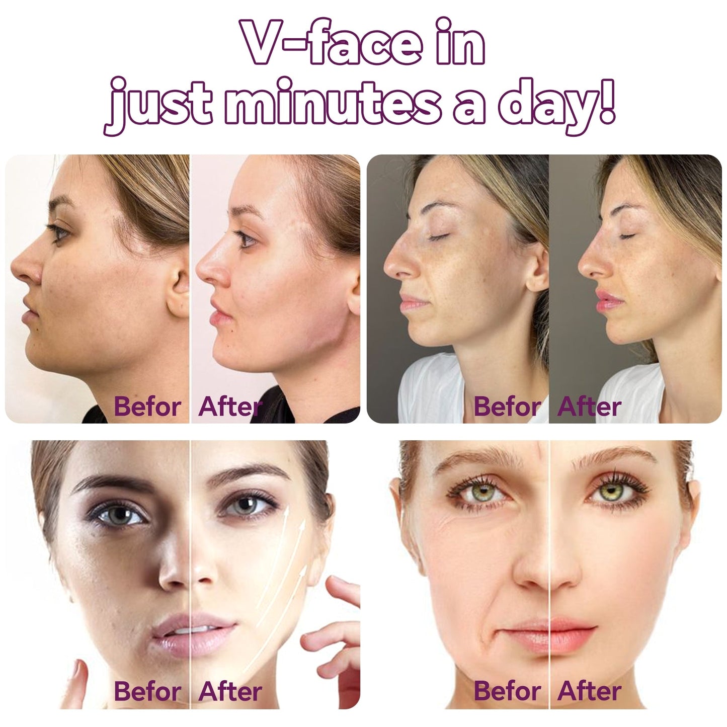 💎💎V-Slimming & Lifting Mask Bandage（1-day quick results for a perfect jawline）