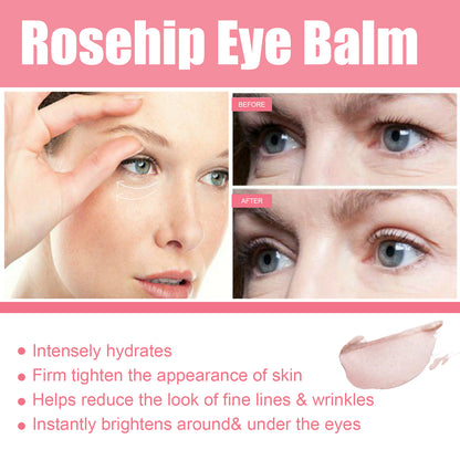 🌹Rosehip Eye Cream Stick - De-puffing and Moisturizing(probiotic skincare)