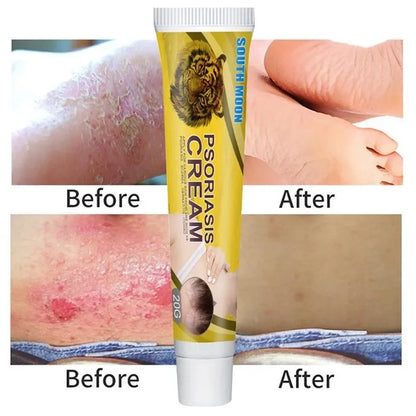 🐝🐝South Moon Bee Venom Skin Cream(FDA Recommended)-Suitable for all skin types