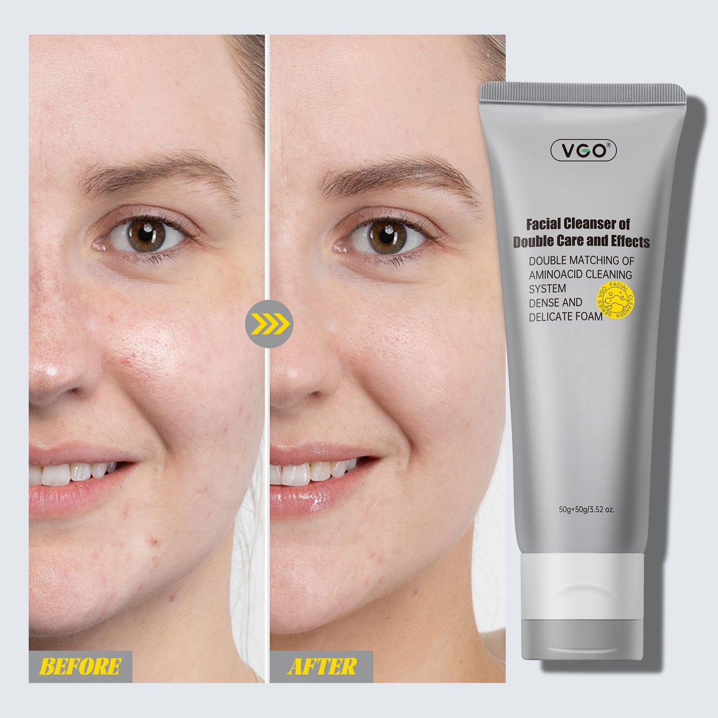 💎VGO Cleansing Cream - Cleansing and whitening, double treatment