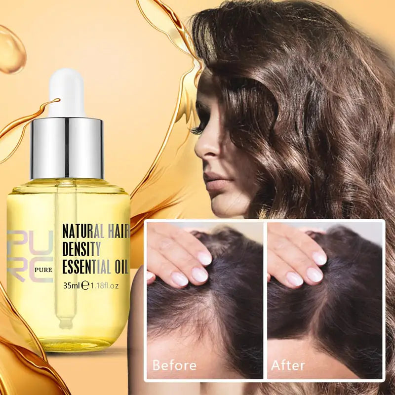 Liquid Gold Scalp Essence | Stop balding 👑 From Only $9.99 Each